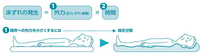 床ずれ防止
